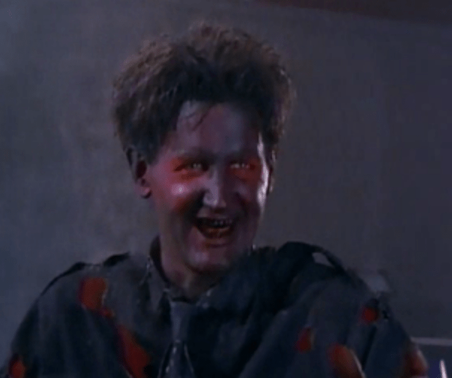 He’s so toasted even his teeth are burnt.